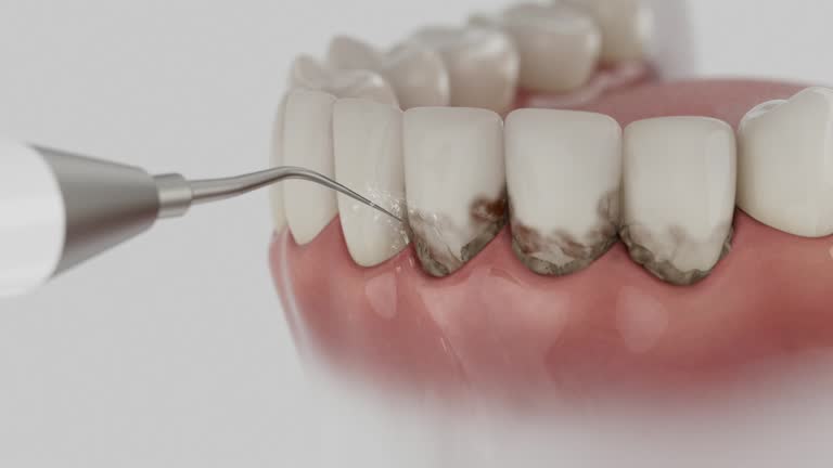 Trusted Dental Implants service in Holly Springs, GA - Dentist Open Now